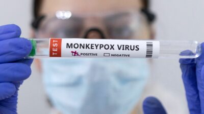 Apa Itu Monkeypox atau Cacar Monyet?