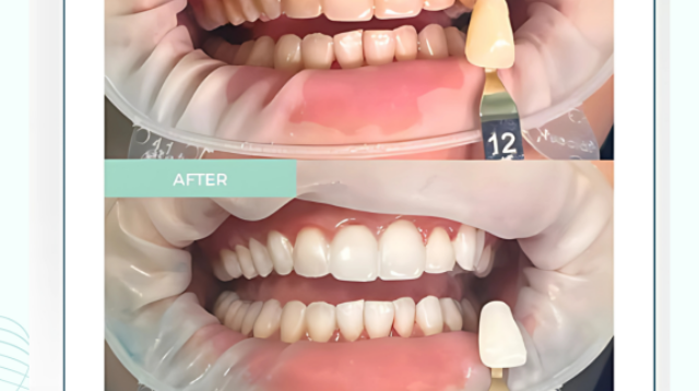 Klinik Gigi Estetik di Surabaya Hadirkan Perawatan Komprehensif dengan Standar Modern dan Harga Transparan