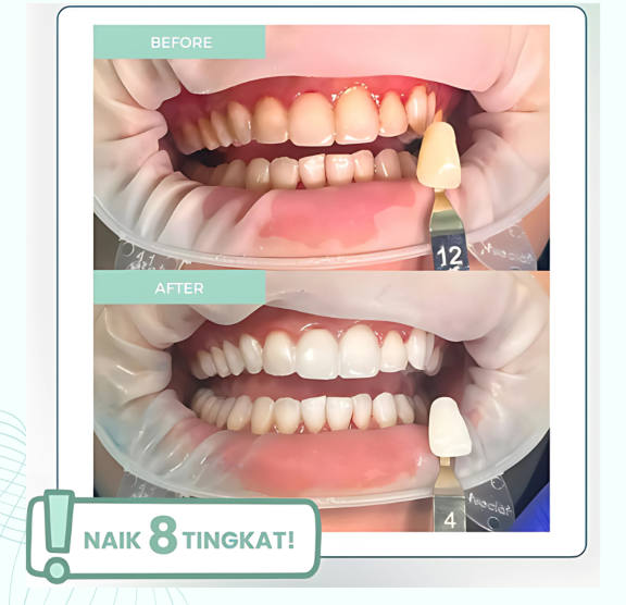 Klinik Gigi Estetik di Surabaya Hadirkan Perawatan Komprehensif dengan Standar Modern dan Harga Transparan
