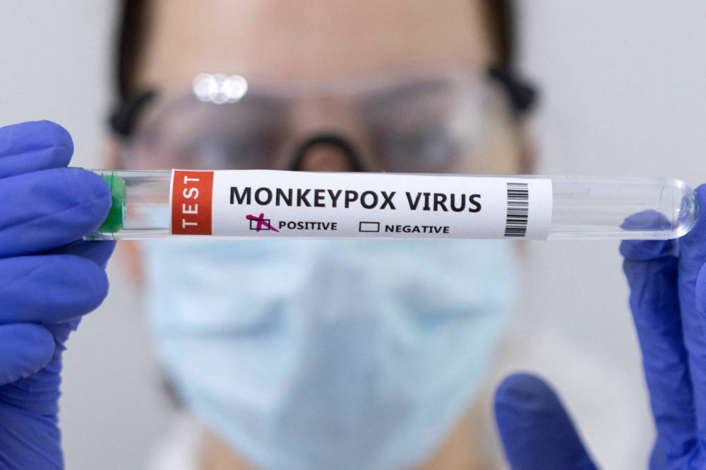 Apa Itu Monkeypox atau Cacar Monyet?