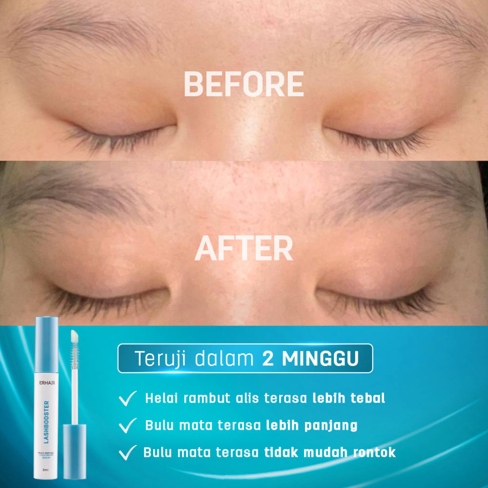 Erhair Lashbooster: Multi-Peptide Lash & Brow Serum dengan Formula Inovatif untuk Pertumbuhan Bulu Mata dan Alis yang Optimal